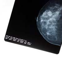 Cancer Breast Cancer Mammogram Breast